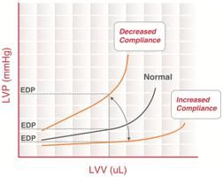 이완 상태의 심실이 뻣뻣할수록 이완기말 압력-용적 관계를 나타내는 곡선은 좌상단으로 옮겨 가며, 유순할수록 우하단으로 옮겨 간다.