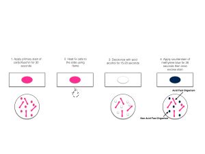 질-닐슨 염색 절차의 기본 단계