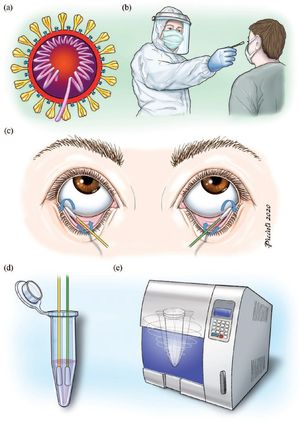 결막 도말 절차