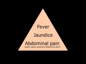 샤르코 삼징의 세 가지 증상: 복통, 황달, 발열