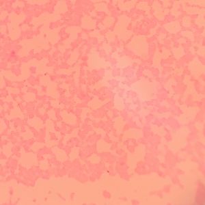 사프라닌으로 염색된 표피포도상구균(x1000)