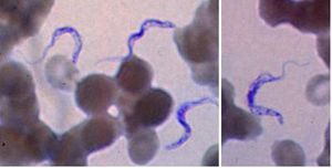 아프리카 수면병 환자의 혈액 도말 표본, 김자 염색으로 염색: 후방 키네토플라스트, 중앙 핵, 파동막, 전방 편모가 있는 트리파노소마 형태. 인간 트리파노소마증을 유발하는 T. b. gambiense와 T. b. rhodesiense는 형태학적으로 구별 불가. 트리파노소마의 길이는 14~33 μm. 출처: CDC.