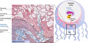 자궁유를 보여주는 태아-모체 경계