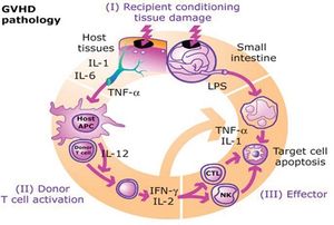 이식편대숙주병 병리