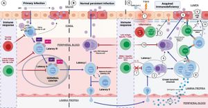 유전적 감수성이 있는 환자에서 엡스타인-바 바이러스(EBV) 유도 후천성 면역 결핍의 발달