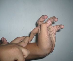 과운동성 손가락