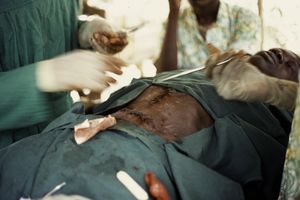 열한 개의 단순 봉합으로 두 개의 수술 상처를 봉합하는 모습