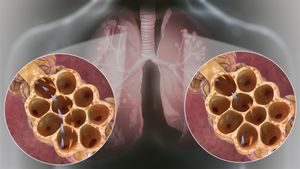 과호흡(왼쪽)과 과다호흡(오른쪽) 비교