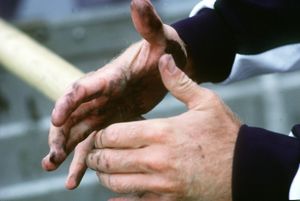 국제 군사 스포츠 행사 Seaweek에 참가한 선수의 손에 굳은살이 덮여 있다.