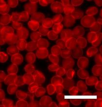형광 현미경으로 본 인간 적혈구. 세포막은 형광 염료로 염색되었다. 스케일 바는 20μm이다.
