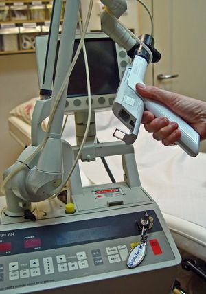 연조직 레이저 수술에 사용되는 40와트 CO2 레이저