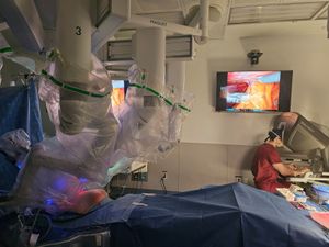 콜롬비아 헤르니아 센터의 외과의가 로봇 플랫폼을 사용하여 큰 탈장 환자를 수술하고 있다.