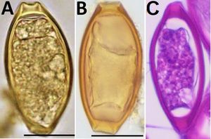 Trichuris trichura의 알. 이미지 C는 HE 염색을 보여준다.