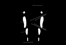 사람 후두의 기본 부분