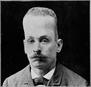 소아 수두증으로 인한 두개 기형을 보이는 성인