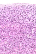 정상 송과선의 현미경 사진 – 중간 배율