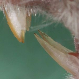 집쥐의 위 앞니