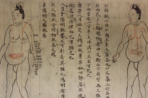 《의심방(醫心方)》에 실린 임산부와 태아 그림