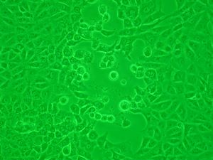 헤르페스 단순 바이러스의 세포병변 효과. 감염된 세포가 둥글고 풍선 모양이 되었다.