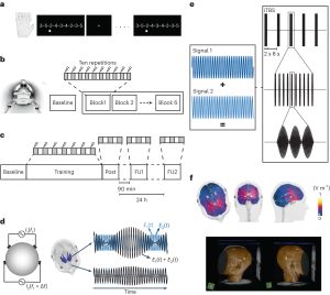 시냅스 활동과 운동 능력 학습을 향상시키기 위한 인간 선조체의 비침습적 세타 버스트 자극 실험 설정