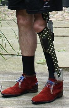 보조기 (입각기 제어 무릎 관절 포함)