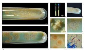 6주 동안 37°C에서 Löwenstein-Jensen (A) 배지와 Ogawa 배지(B)에서 배양된 결핵균(Mycobacterium tuberculosis).
