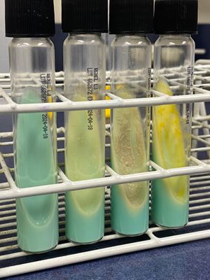 뢰벤슈타인-옌센 배지. 왼쪽부터: 음성 대조군, M. tuberculosis: 건조한 집락, 마이코박테리움 아비움 복합체: 습한 집락, M. gordonae: 황색 집락