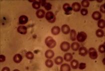 사람의 적혈구. 포유류 중에서는 사람이 비교적 큰 적혈구를 가지고 있다.