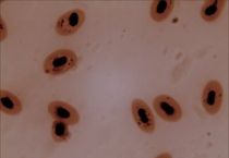 물고기의 적혈구. 위의 이미지와 같은 배율이다. 물고기의 적혈구는 타원형이며 핵을 가지고 있다.