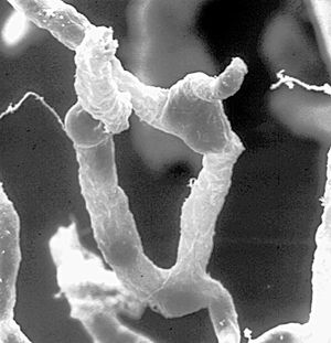 뇌세포에 혈액을 공급하는 모세혈관 네트워크의 일부