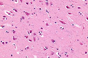 현미경 사진은 대상 피질의 방추 신경 세포를 보여준다. HE-LFB 염색