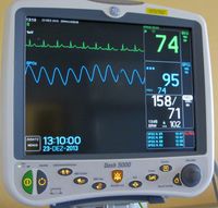 일반 병동의 3점 유도식 모니터