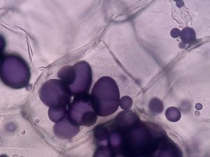 감자의 세포 내 녹말 입자