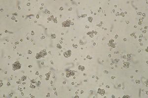 광학 현미경으로 관찰한 쌀녹말. 쌀녹말의 특징은 녹말 과립이 각진 윤곽을 가지며, 그 중 일부는 서로 붙어서 더 큰 과립을 형성하는 것이다.