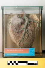 단봉낙타의 심장 표본