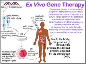 Ex vivo gene therapy