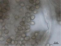 R. stolonifer의 특징적인 줄무늬가 있는 보석 모양의 포자낭포자