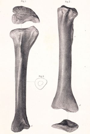 19세기에 제임스 에르스레벤이 그린 석판화, 옆면(왼쪽), 뒷면(오른쪽)에서 본 참고된 경골