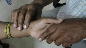 아유르베다의 맥진