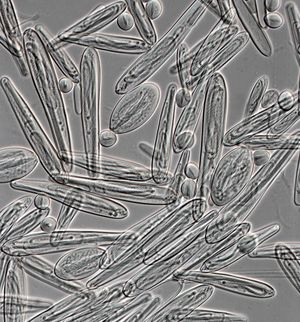 Chironex fleckeri의 자포 (400배 확대)