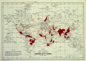 1891년 세계 나병 분포도
