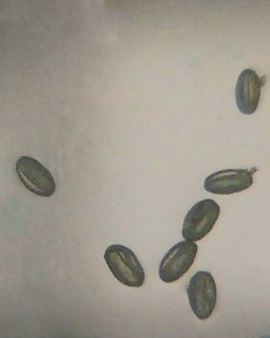 Lagenaria siceraria의 꽃가루 (크기: ~60 마이크로미터)