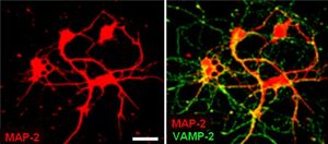 Microtubule-associated protein