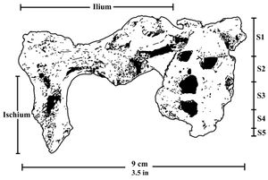 엉치뼈, 오른쪽 엉덩뼈, 궁둥뼈의 윗부분을 보존한 정면 골반