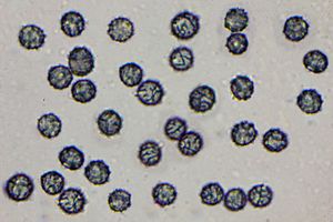 젖버섯속의 포자. 거친 암청색 능선 질감의 장식이 특징이다.