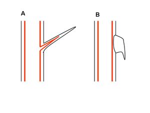 (A) 가시 또는 가시털(B) 가시