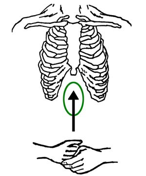 복부 압박 시 손 위치를 보여주는 그림