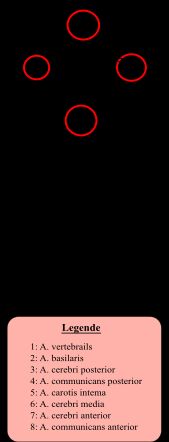 윌리스 환과 파열된 동맥류의 가장 흔한 위치