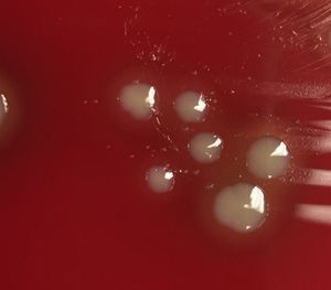 혈액 한천 배지에서 Haemophilus influenzae 위성 집락(핀 포인트)과 Staphylococcus aureus(노란색)