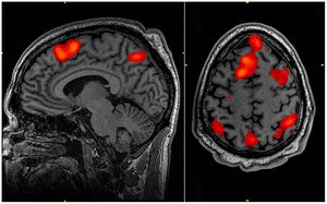 이 특정 기능적 자기 공명 영상(FMRI) 스캔은 작업 기억 과제 동안 뇌의 어떤 영역이 활성화되는지 결정했지만, 이러한 유형의 영상은 몰입 경험 동안 활성화되는 뇌의 영역도 결정할 수 있습니다.